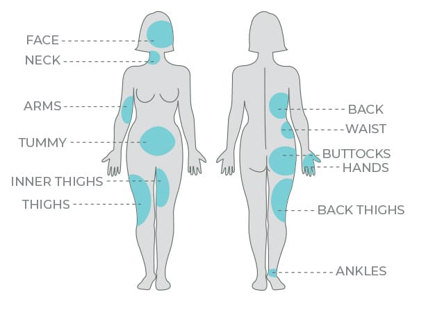 Body contouring treatment areas diagram showing face, neck, arms, tummy, thighs, back, and ankles